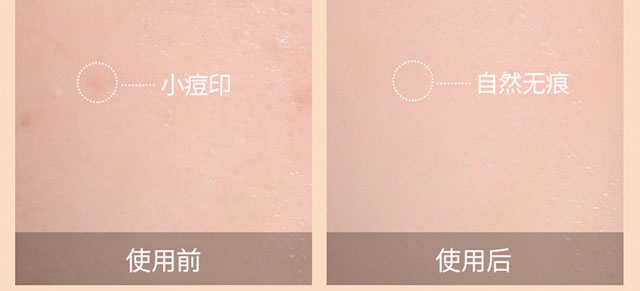 ��ȷ��o(h��)����BB˪