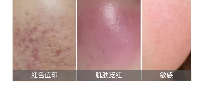 �t(y��)ʩ�����������o(h��)Һ