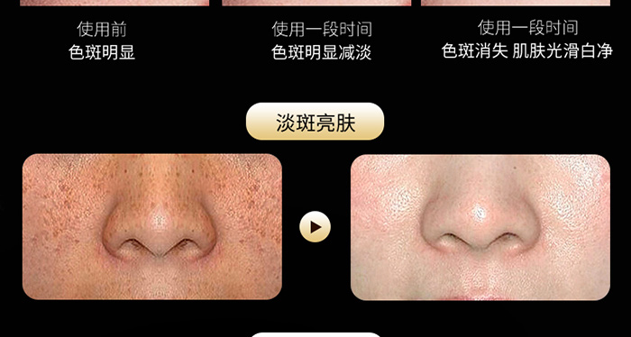 ϧ��܎����݌���